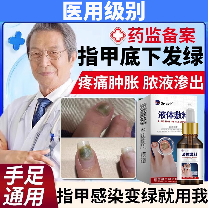 指甲绿脓杆菌变癣空床分离