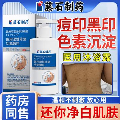 后背痘印黑色素沉淀去除淡