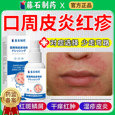 口周皮炎嘴巴围红斑丘疹瘙