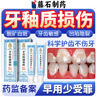 牙釉质损伤牙齿脱矿可搭配修补复护液用有白斑牙膏敏感酸痛专用YZ