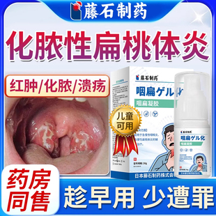 扁桃体发炎化脓性专用喉咙肿痛肿大喷雾剂儿童急慢咽喉药房同售WQ