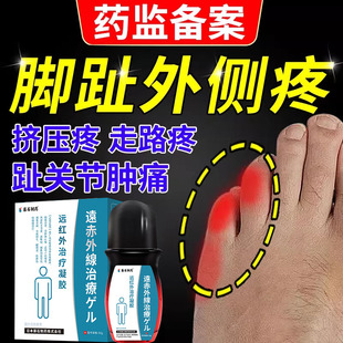 小脚趾疼痛外侧挤压磨出茧子小拇指脚指头关节肿痛搭膏TU