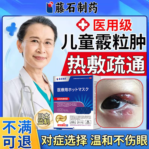 儿童蒸汽眼罩霰粒肿热敷睑