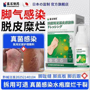 藤石制药糜烂型脚气足癣真菌感染引起脚糜烂脱皮水疱脚后跟干裂SY