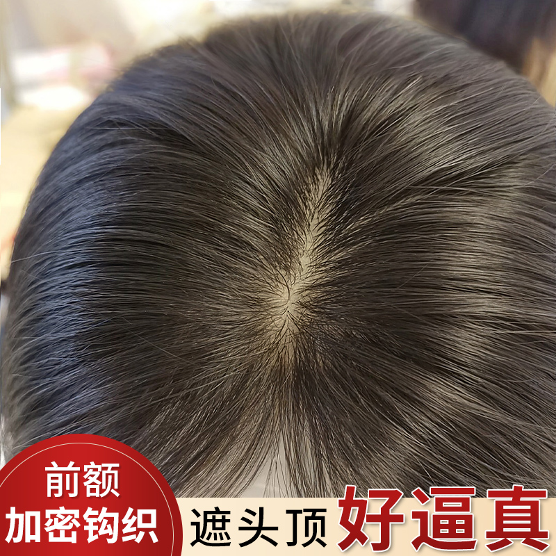 递针假发女片头顶真发薄款无痕增发量蓬松高颅顶遮白发刘海补发片