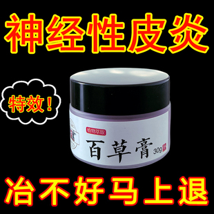 神经性皮炎外用膏日光性防紫外线过敏性晒伤顽固皮肤瘙痒止痒乳膏