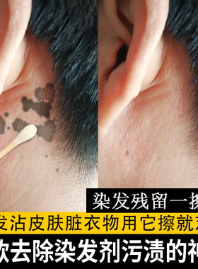 汉斯一擦净去除染发剂污渍去染发膏的美发清洁剂皮肤残留染色染膏