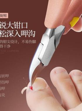 foot hand dedicated ingrown toenail in embedded a pedicure