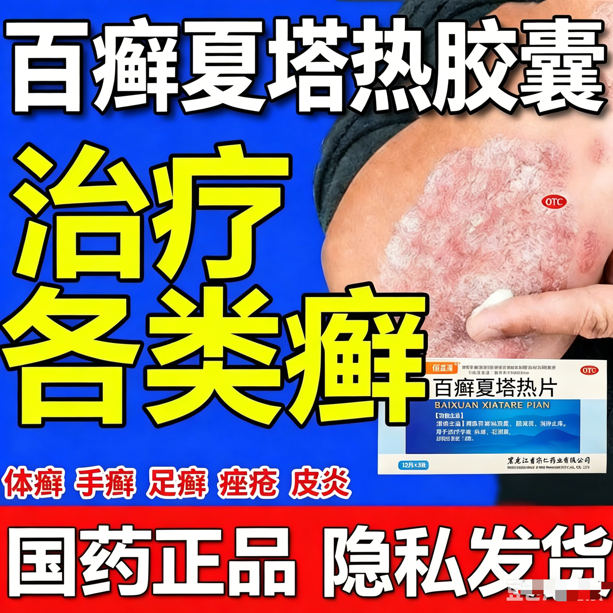 百癣夏塔热正牌胶囊官方旗舰店正品止痒牛皮癣银屑病特专用效药膏