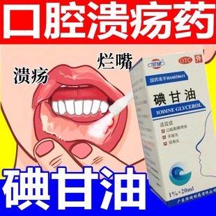 【今天发】碘甘油正品口腔溃疡特效的药官方旗舰店医用牙周炎牙龈