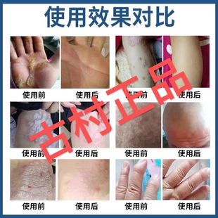 古村奇草甄藏奇草厂家正品抑菌乳膏通络膏止痒批发舒通抑菌皮肤