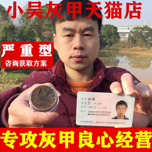 指甲发黄发灰增厚凹凸不平甲沟灰指甲足部敷料官方正品