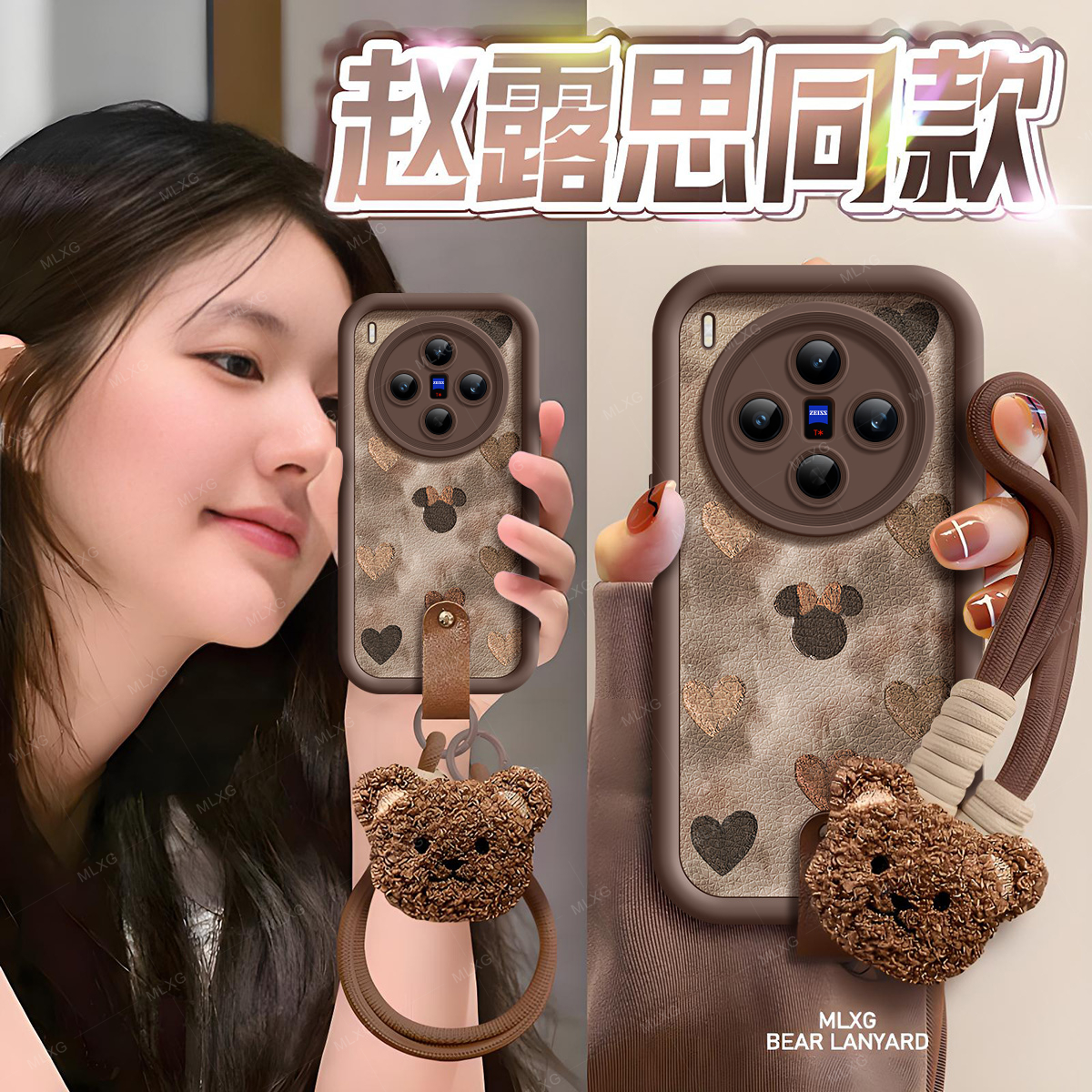 适用vivoX300手机壳卡通皮纹