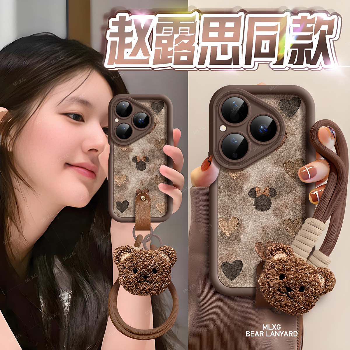 适用华为Pura80手机壳卡通皮纹