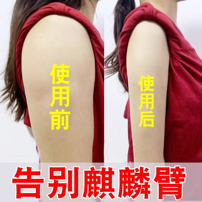 去手臂神器大粗胳膊细蝴蝶减拜拜肉告别麒麟臂女神燃脂贴快速瘦腿