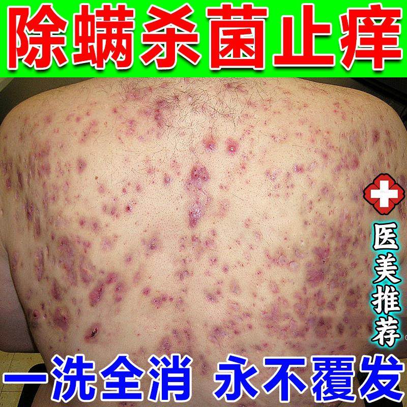 洗澡用的浴盐消炎杀菌止痒牛奶泡浴盐