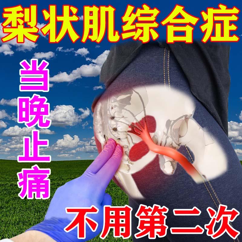 治疗梨状肌综合症特效药腿疼屁股疼腰疼腰椎压迫坐骨神经疼贴膏