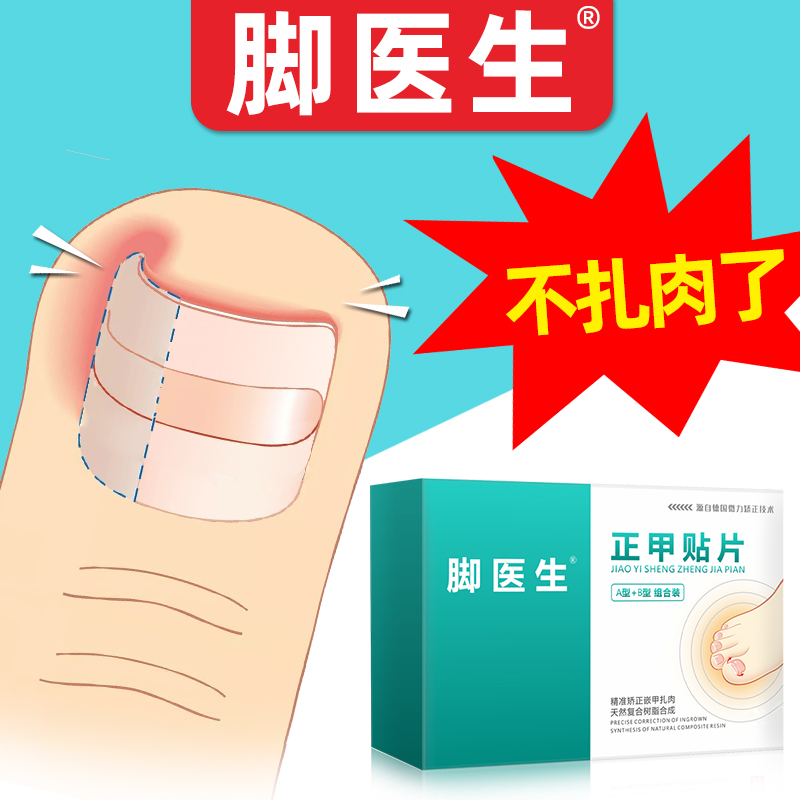 脚医生甲沟炎嵌甲专用拉拉指甲矫正器正甲贴片非药膏趾指甲长肉里|ruв категории ОТК лекарств/медицинское оборудование/МФПР товаров, медицинское оборудование, Здравоохранение физиотерапии - от Buy2taobao.com для оказания профессиональной услуги покупки агента Taobao