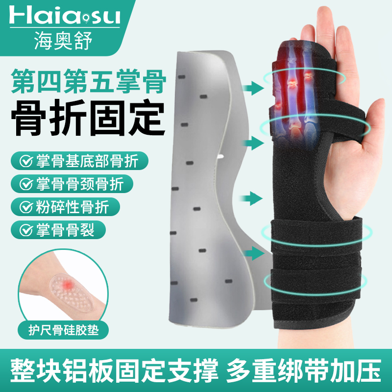 掌骨骨折固定支具，助力骨折康复