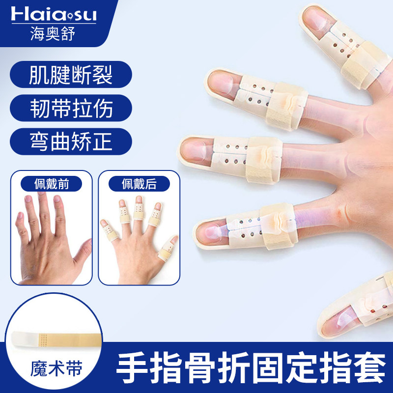 手指骨折固定指套医用术后弯曲矫正肌腱韧带损伤美甲指甲断裂护具