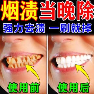 强力去烟渍牙膏去牙渍牙垢黄牙茶渍牙神器牙结石克星一擦即除牙膏