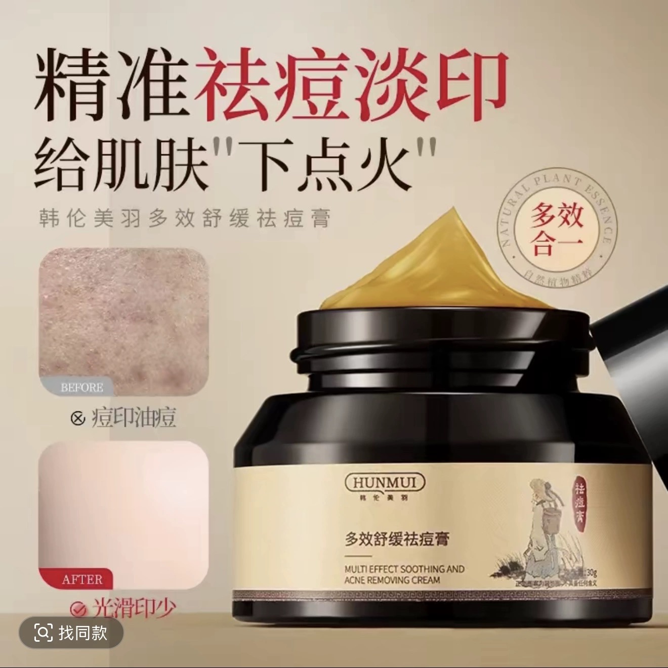 买一送一韩伦美羽多效舒缓祛痘膏祛痘淡印痘印闭口粉刺祛痘霜