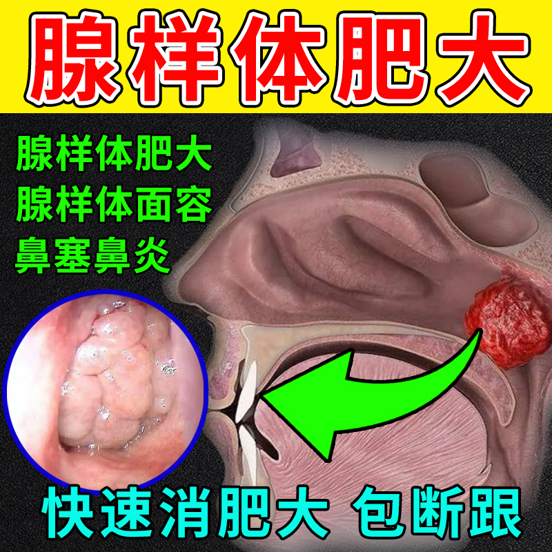 百年张氏匠心巨制腺样体中药贴