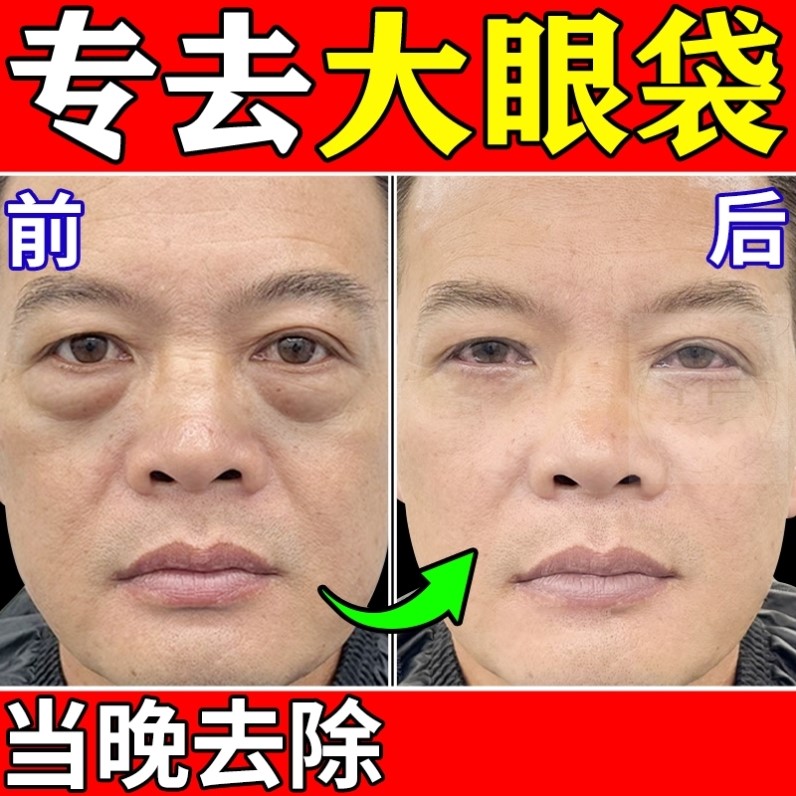 眼袋去除神器男士一分钟强力专用霜淡化黑眼圈细纹提拉紧致第一名