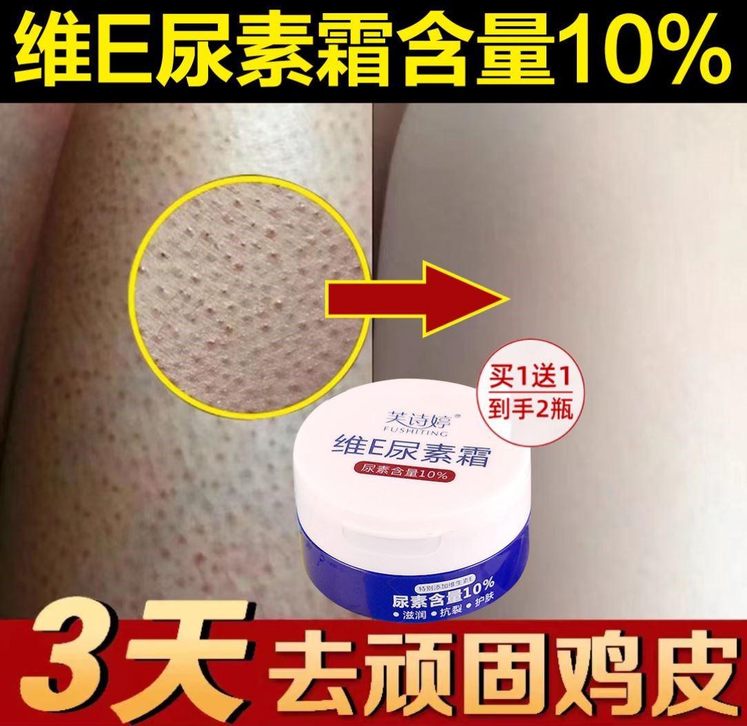 倍润清去鸡皮疙瘩图片(倍润清去鸡皮一套多少钱)