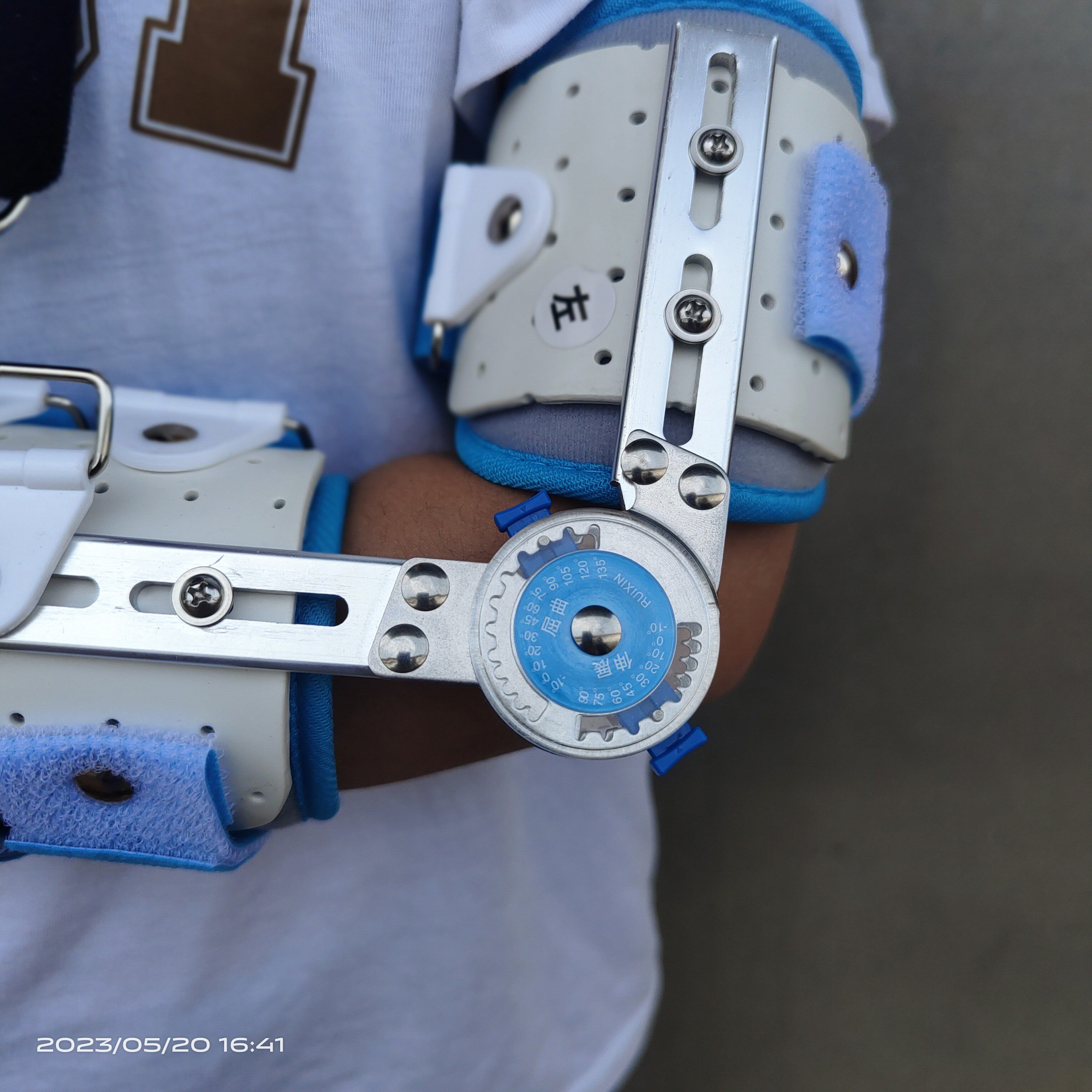 儿童定做手臂肱骨骨折可调肘关节固定支具需测量尺寸联系客服备注