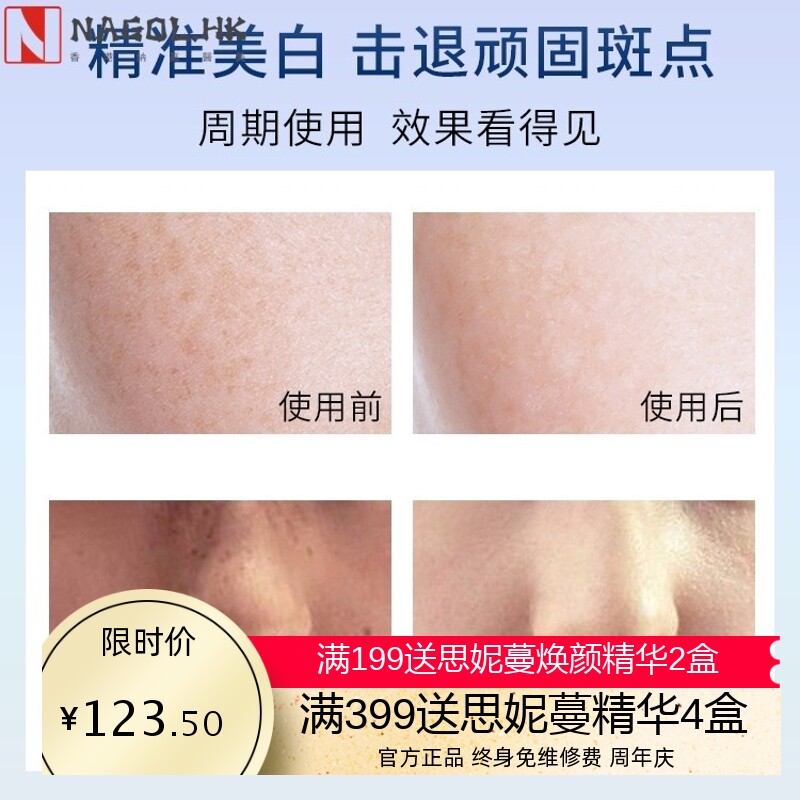 凝诺美白祛斑霜雀斑晒斑祛黄淡斑脸部保湿面霜美白祛斑霜套盒