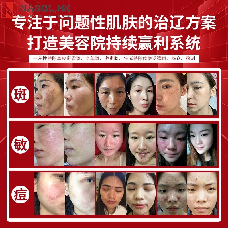 美白精华液去黄提亮肤色打造素颜灯泡肌改善暗沉淡化色斑美白晚霜