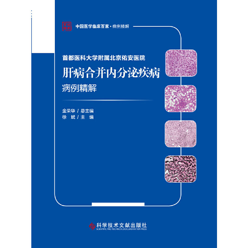 首都医科大学附属北京佑安医院肝病合并内分泌疾病病例精解