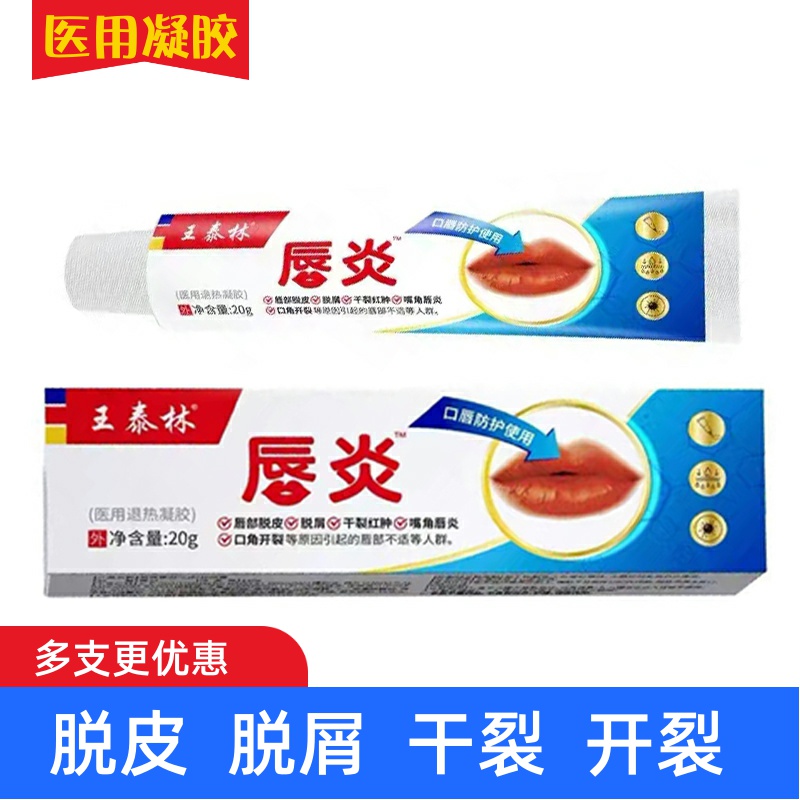 王泰林唇炎唇部润唇膏20g缓解唇