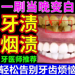 强力去烟渍牙膏洗牙粉抗敏去黄牙齿亮白茶渍口臭结石菌斑洗牙神器