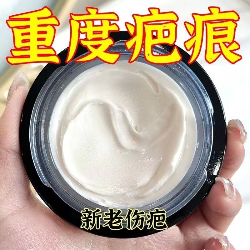 小红书推荐正品无痕消除修