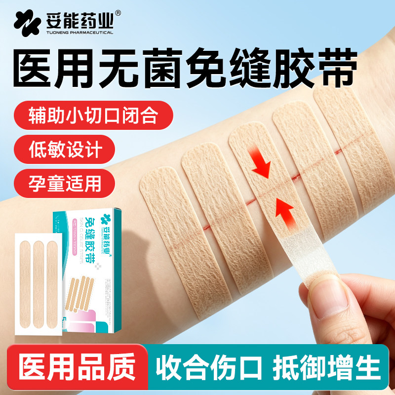 妥能医用皮肤减张贴减张器手术后伤口免缝合胶带儿童面部疤痕
