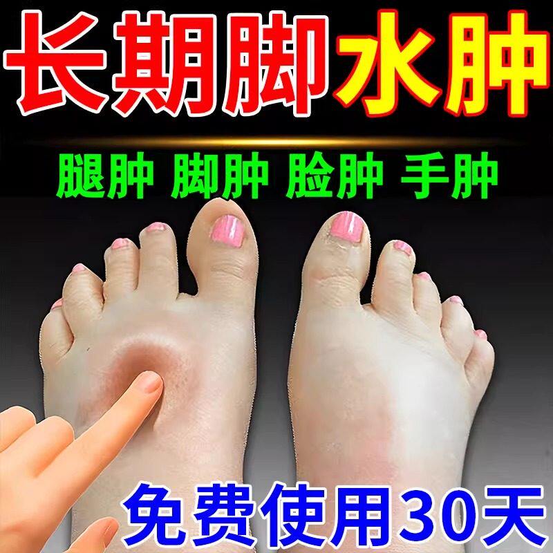 【脚肿，腿肿，手肿】喷剂