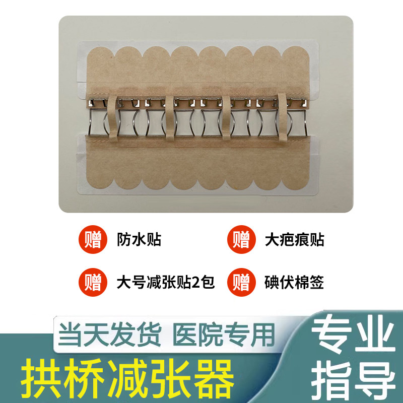 剪张奇拱桥形减张器疤痕剖腹产骨科术后皮肤伤口免缝防变宽缝合器