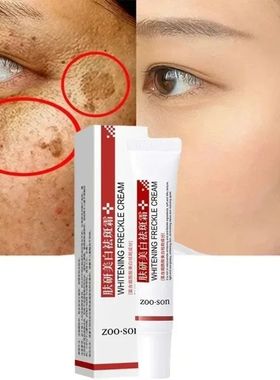Whitening Freckle Cream Remove Dark Spots Anti Freckle Face