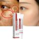 Freckle Spots Cream Whitening Remove Dark Anti Face