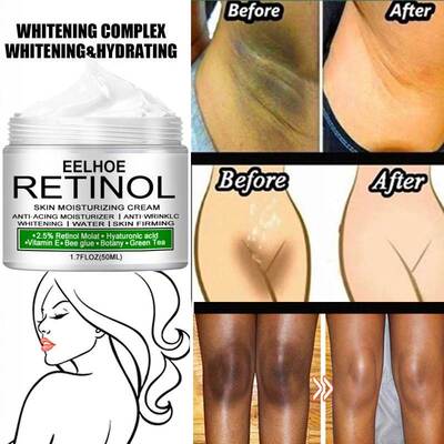 BodyWhitengCreamSkTIm