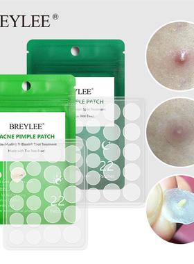 Acne Pimple Patch  Stickers Treatment Pimple Remover 痘痘贴