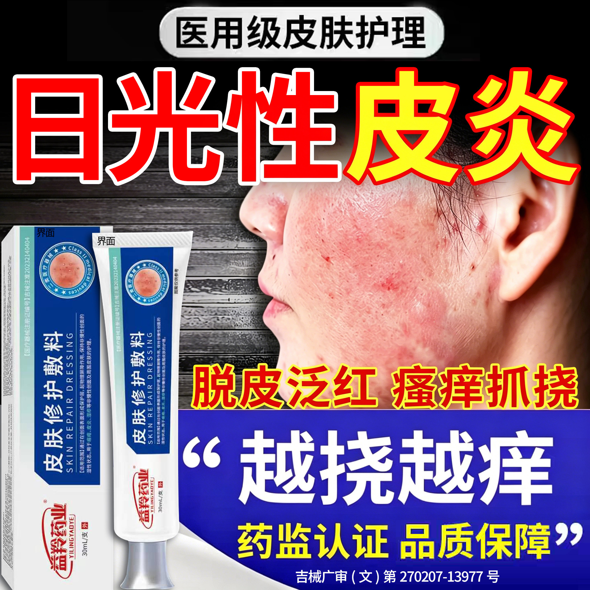 阳光日光性皮炎紫外线过敏修复霜专用膏太阳晒伤皮肤发痒止痒FY