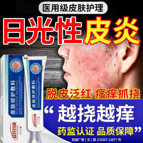 阳光日光性皮炎紫外线过敏修复霜专用膏太阳晒伤皮肤发痒止痒FY