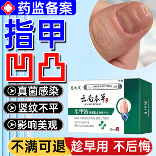 指甲凹凸不平修复液真菌感染甲面竖纹受损不平甲床分离专用精华WY