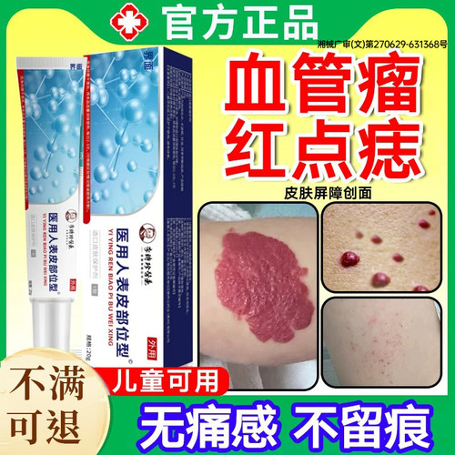 血管瘤血管痣去除樱桃状血管瘤点红痣蜘蛛痣去身上红痣黑疙瘩PP
