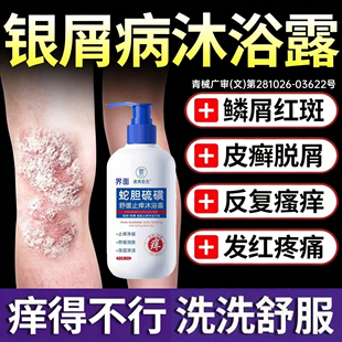 牛皮癣银屑病藓专用旗舰店体癣去红斑抑菌止瘙痒杀菌硫磺沐浴露PP