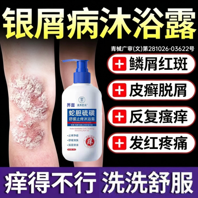 牛皮癣银屑病藓专用旗舰店体癣去红斑抑菌止瘙痒杀菌硫磺沐浴露PP