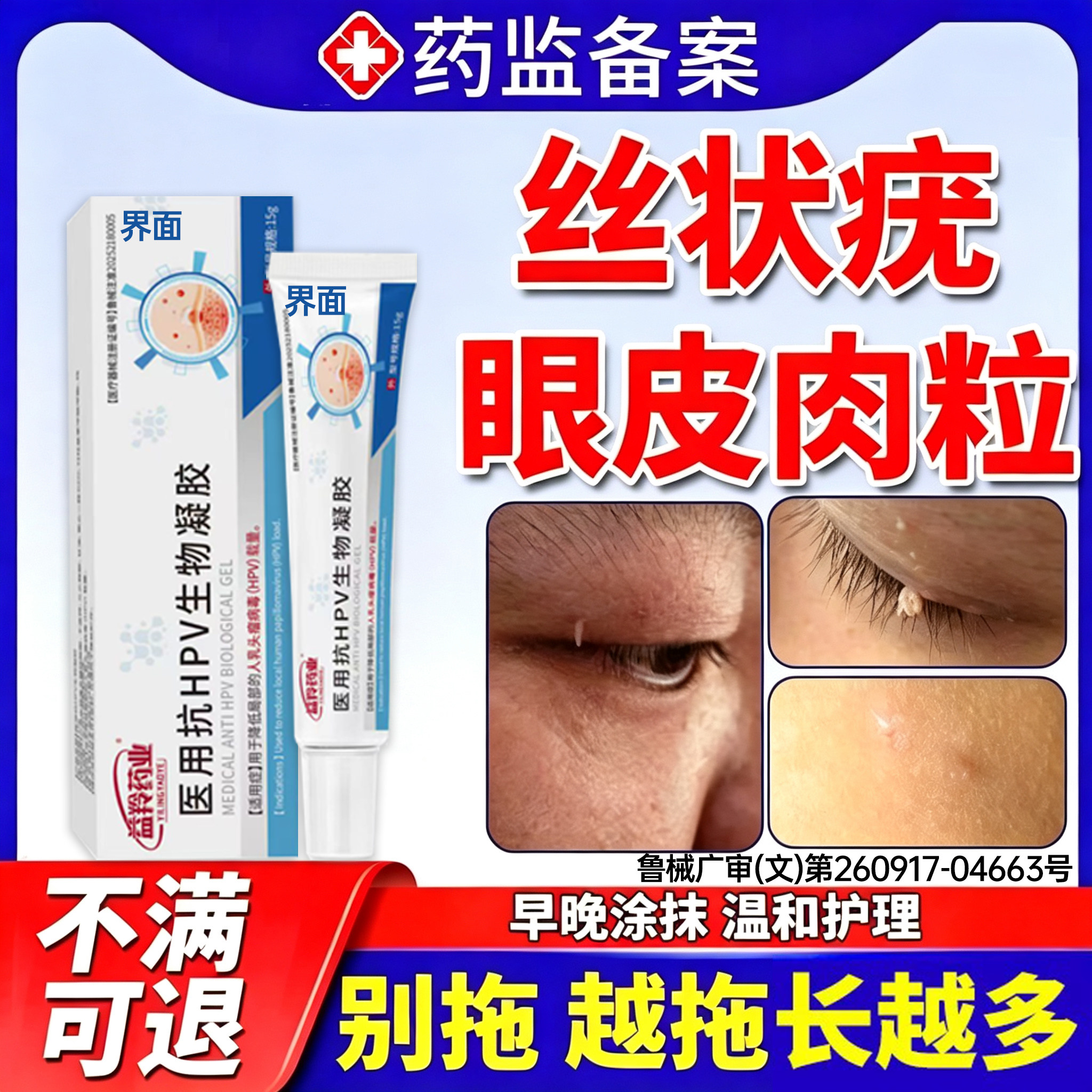 眼皮上长小肉粒丝状疣去除神器专用膏去脸上疙瘩根扁平疣面颈部PP